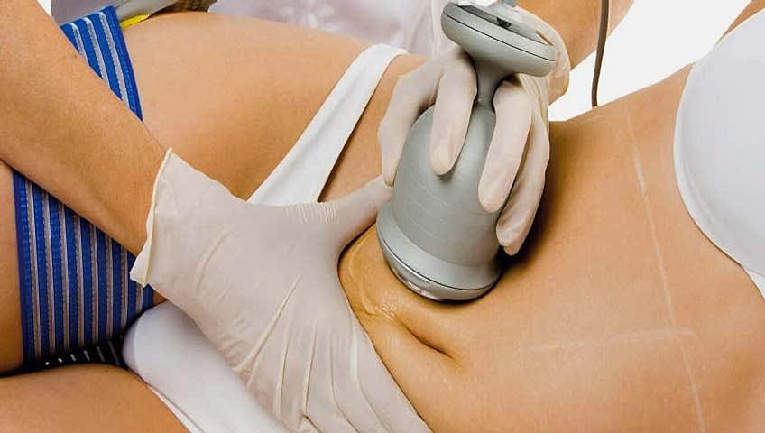 Radyo frekanslı termokoagülasyon