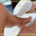 Diode Lazer Epilasyon